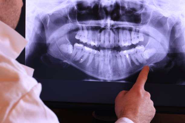Best Emergency Root Canal Treatment in Basye, VA