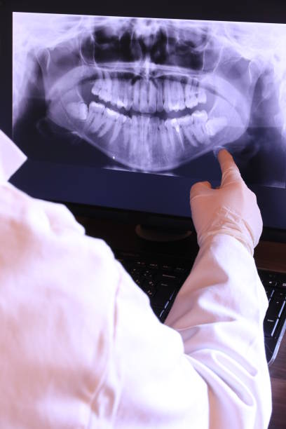 Best Emergency Dentist for Knocked-Out Tooth in Basye, VA
